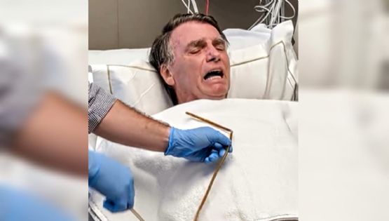 UTI da Fuleragem: Bolsonaro posta remoção de sonda em novo circo de horrores