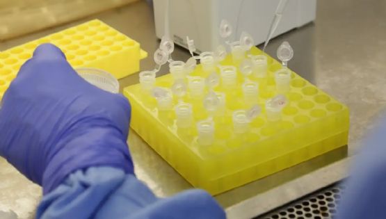 Nova descoberta da ciência avança para cura do HIV com resultado promissor