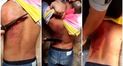 Sessão de tortura: PM do Ceará "raspa" tatuagem de homem na faca 