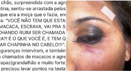 Racismo: Médico e empresária chamam mulher negra de "macaca" e a espancam