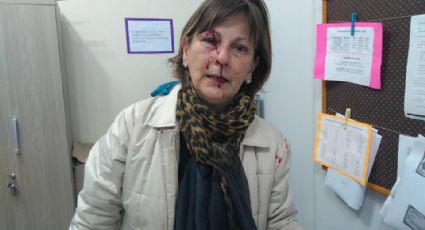 Professora é brutalmente agredida por aluno em escola de SC