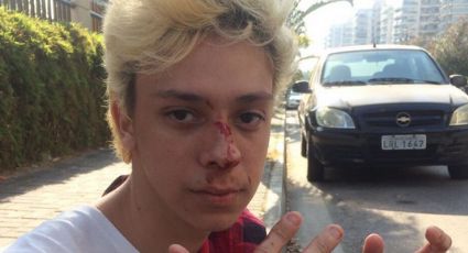 Homofobia: Youtuber é agredido na saída do Rock in Rio