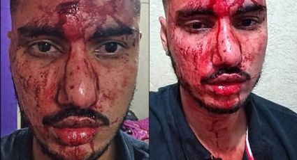 Jovem é atacado e ameaçado com arma por dois suspeitos que não queriam "viadinho" na Penha