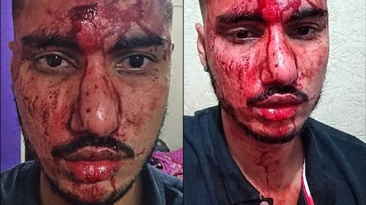 Jovem é atacado e ameaçado com arma por dois suspeitos que não queriam "viadinho" na Penha