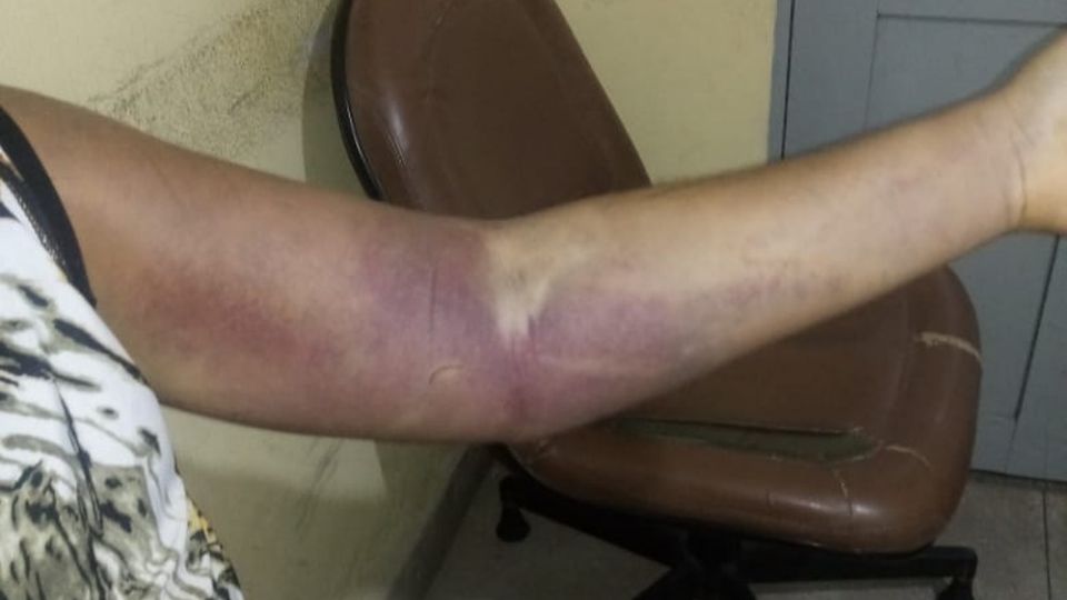 Agressão à mulher em Pernambuco. Foto: PM