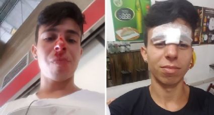 Jovem relata agressão, homofobia e negligência de seguranças em terminal de ônibus de SP