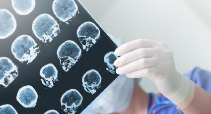 O que é morte cerebral ou encefálica e qual o protocolo para confirmá-la