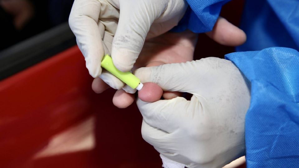Teste rápido para o novo coronavírus. (Foto Divulgação/Governo do Estado de SP)
