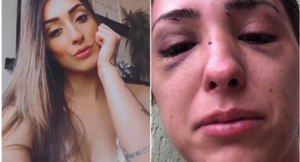 Modelo acusa ex-namorado de agressão depois de terminar relacionamento