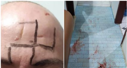 Em MG, homem gay é dopado, tem o corpo cortado com faca e testa desenhada com suástica nazista