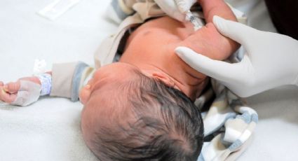 FOTO: Por que um bebê nasceu com uma cauda de 6 cm no México