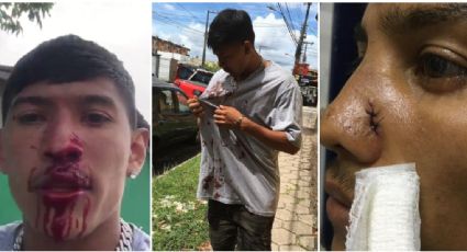 VÍDEO: Bolsonaristas quebram o nariz de jovem que foi celebrar formatura do irmão no Exército