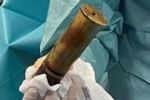 Homem coloca bomba da 2ª Guerra Mundial no ânus e hospital é evacuado