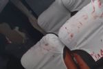 IMAGENS: Bomba atinge ônibus do Bahia e dois jogadores ficam feridos