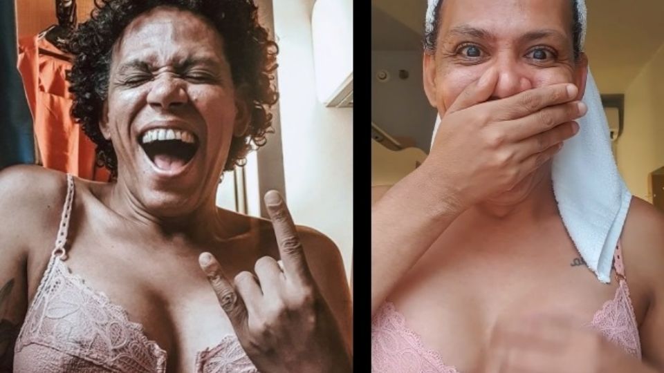 Valéria Barcellos gravou reação ao usar sutiã pela primeira vez após cirurgia