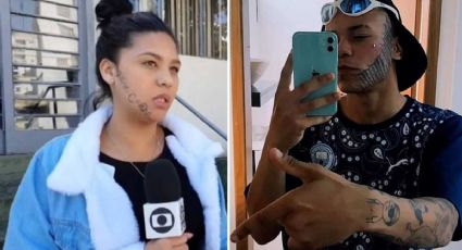 FOTO: Jovem tatuada à força no rosto pelo ex faz primeira sessão de remoção