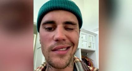 VÍDEO: Justin Bieber aparece com metade do rosto paralisado devido a doença rara