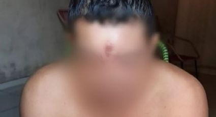 Como é possível rapaz baleado na cabeça no TO ter ido para casa dormir