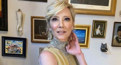 Morte da atriz Anne Heche é confirmada por familiares