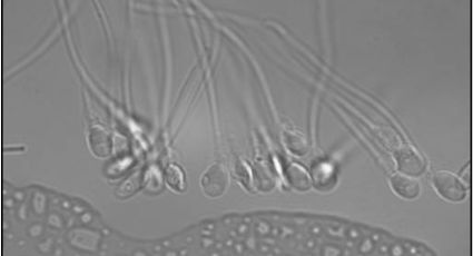 Espermatozoides desafiam lei centenária da física, revela nova descoberta científica