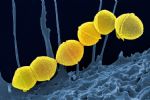 Streptococcus Pyogenes: O que é bactéria que já provocou 93 mortes na Argentina