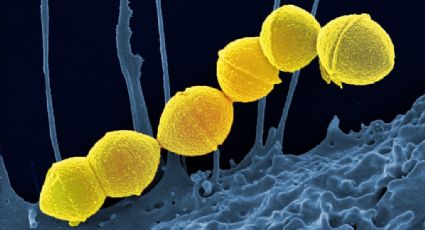 Streptococcus Pyogenes: O que é bactéria que já provocou 93 mortes na Argentina