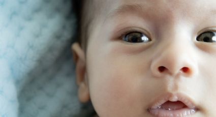 Anquiloglossia: O que é a doença alvo de Nota Técnica do Ministério da Saúde