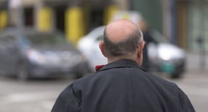 Novo estudo pode indicar cura para a calvície; entenda