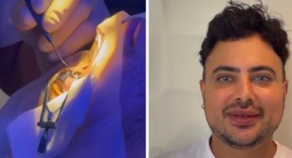 VÍDEO: Os perigos do procedimento para mudar a cor dos olhos