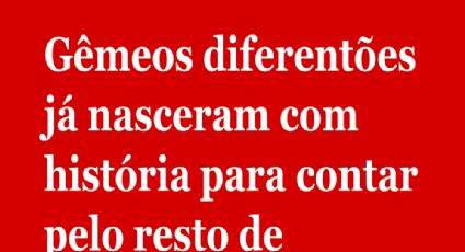 Gêmeos diferentões já nasceram com história para contar pelo resto de suas vidas