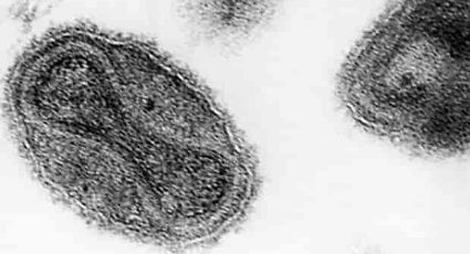 EUA estariam fazendo experimentos proibidos pela OMS com a varíola, afirma inteligência russa