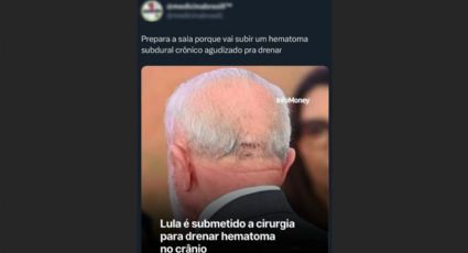 Médicos ironizam internação e desejam a morte de Lula em redes sociais