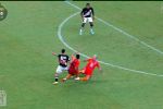 IMAGENS FORTES: Jogador quebra perna em jogo do Vasco em Manaus