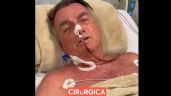 Foto ilustrativa de la nota titulada: Saiba o que Bolsonaro achou da troca de médicos para sua cirurgia
