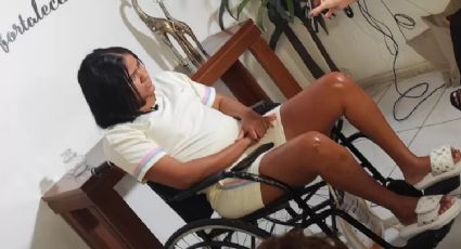 Rio: mulher faz cirurgia para colocar silicone e acorda sem movimentos