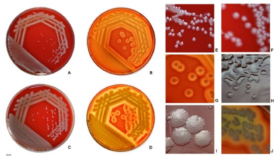 Superbactéria comedora de plástico: cientistas descobrem preocupante microrganismo