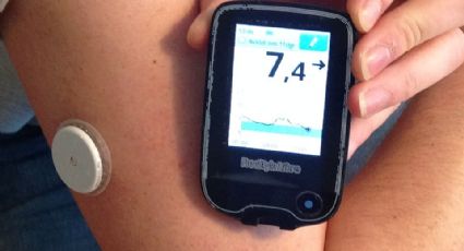 O dispositivo vestível que promete 'revolucionar' diagnóstico para diabetes